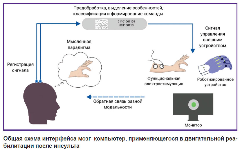 Схема работы интерфейса «мозг-компьютер» 